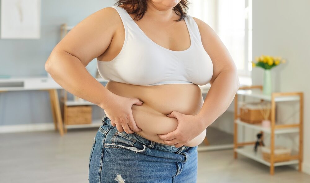 Obesità giovanile in Italia