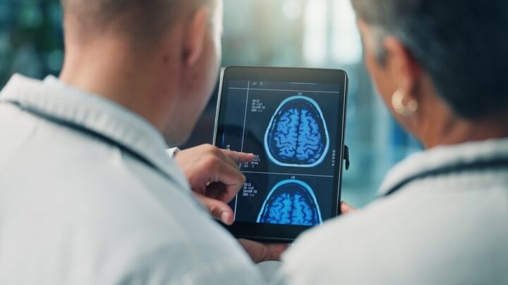 Studio sulla fibrillazione atriale e declino cognitivo